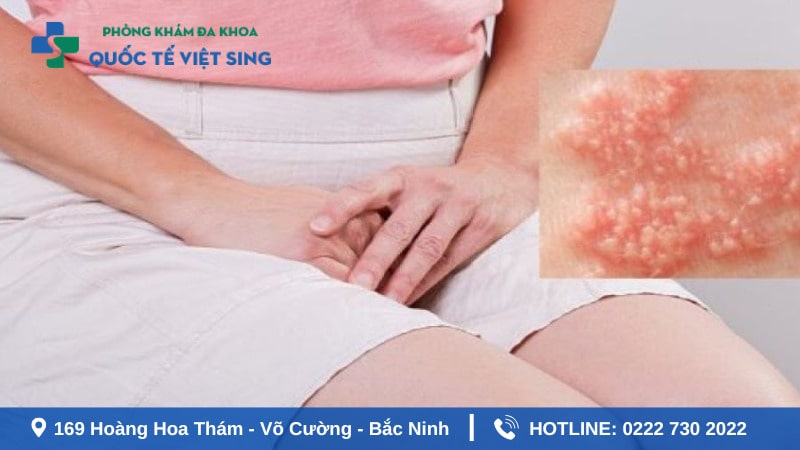 Nguyên nhân gây bệnh sùi mào gà ở nữ giới 