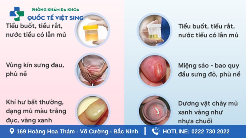 Nguyên nhân và con đường lây truyền bệnh lậu
