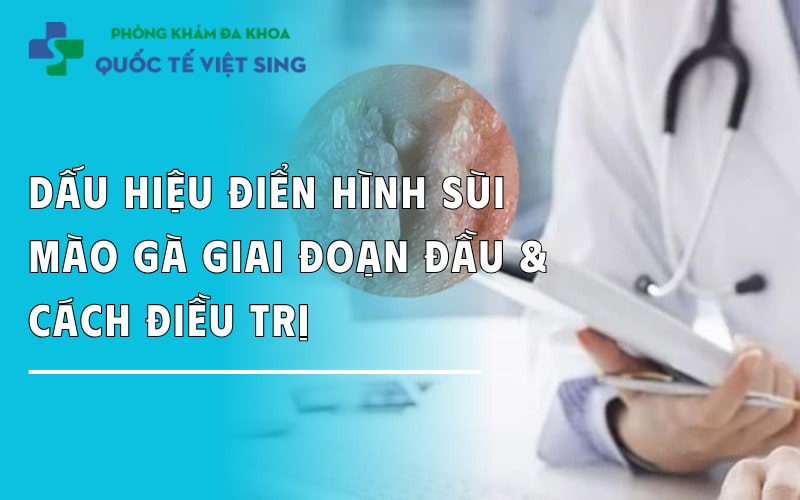 https://dakhoaquoctebacninh.com/wp-content/uploads/2025/07/sui-mao-ga-giai-doan-dau.jpg