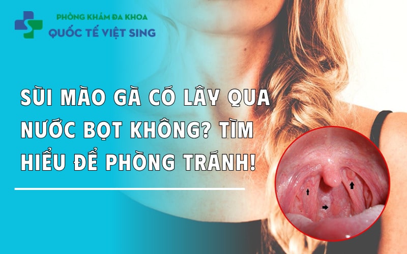 Sùi mào gà có lây qua nước bọt không? Tìm hiểu để phòng tránh!