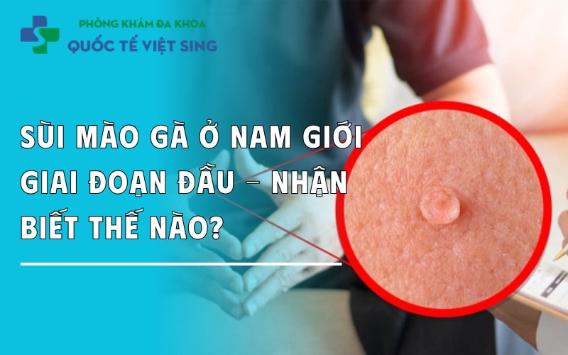 Sùi mào gà ở nam giới giai đoạn đầu – Nhận biết thế nào?
