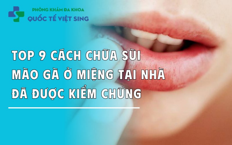 Top 9 cách chữa sùi mào gà ở miệng tại nhà đã được kiểm chứng