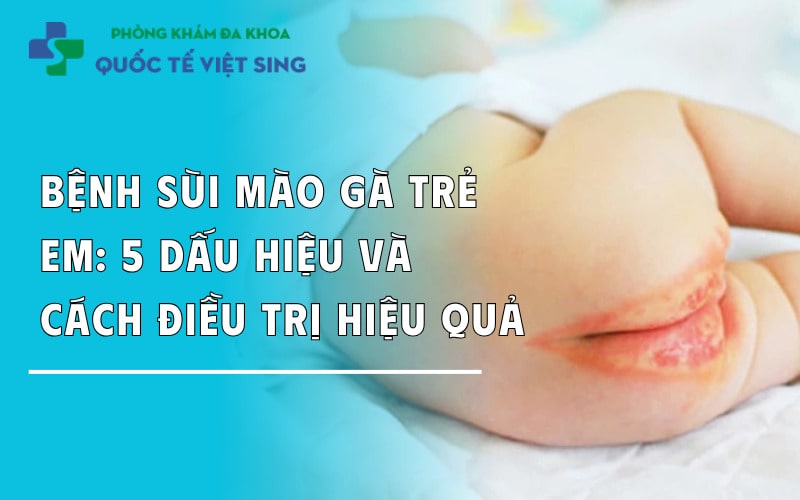 Bệnh sùi mào gà ở trẻ em: 5 dấu hiệu và cách điều trị hiệu quả