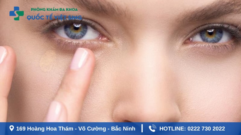 Sùi mào gà ở mắt có nguy hiểm không?