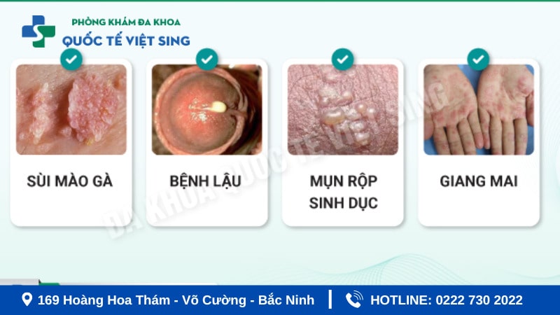 Các bệnh xã hội phổ biến hiện nay