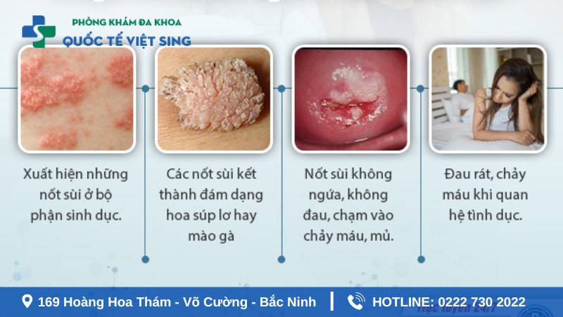 Triệu chứng của bệnh sùi mào gà cần chú ý