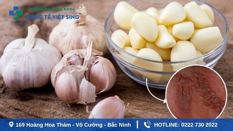 Cách chữa sùi mào gà ở miệng tại nhà bằng tỏi