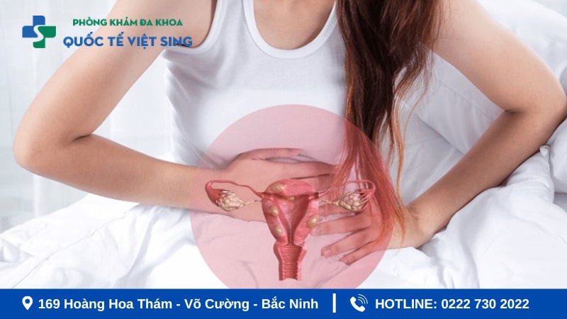 Chậm kinh 1 tháng có nguy hiểm không?