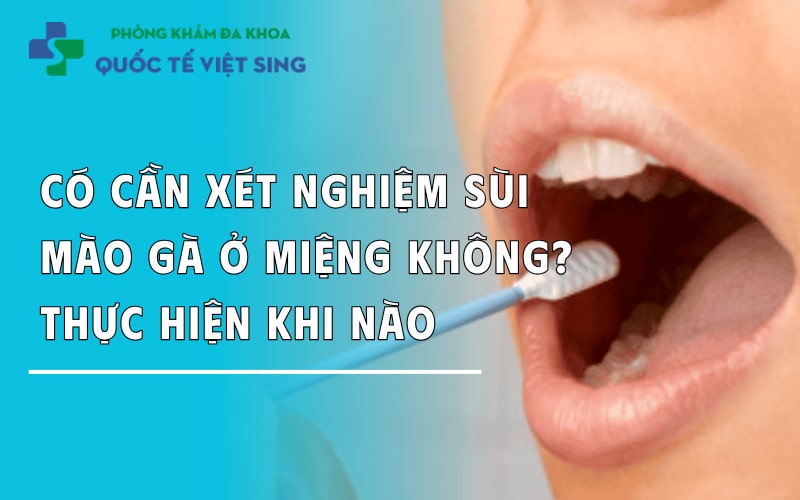 Có cần xét nghiệm sùi mào gà ở miệng không? Thực hiện khi nào