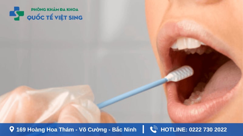 Xét nghiệm sùi mào gà ở miệng khi nào ?
