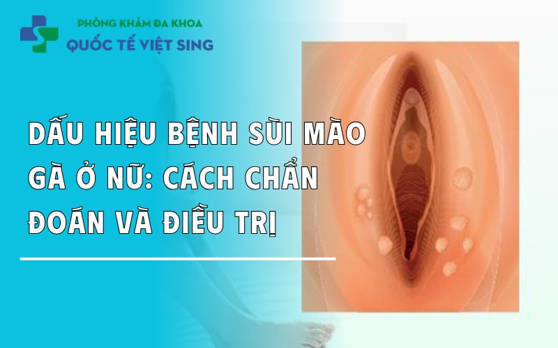 Dấu hiệu bệnh sùi mào gà ở nữ: Cách chẩn đoán và điều trị