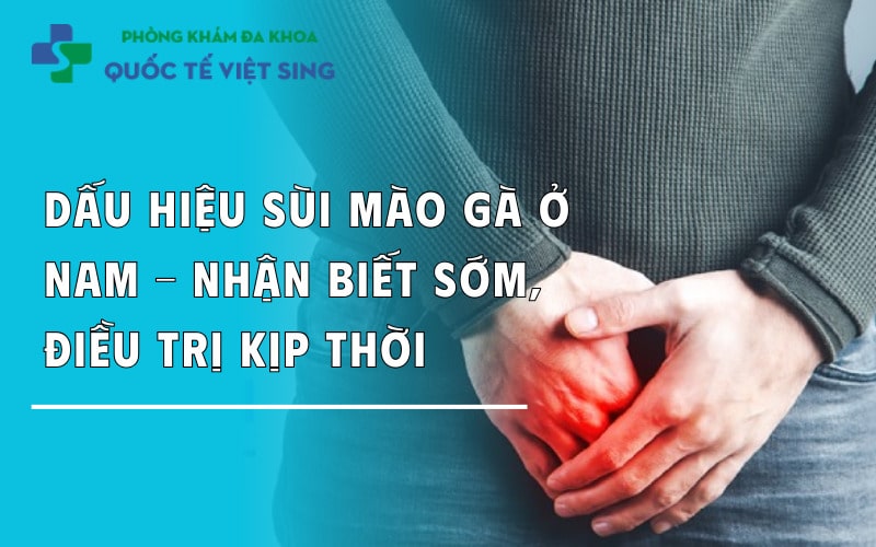 Dấu hiệu sùi mào gà ở nam – Nhận biết sớm, điều trị kịp thời