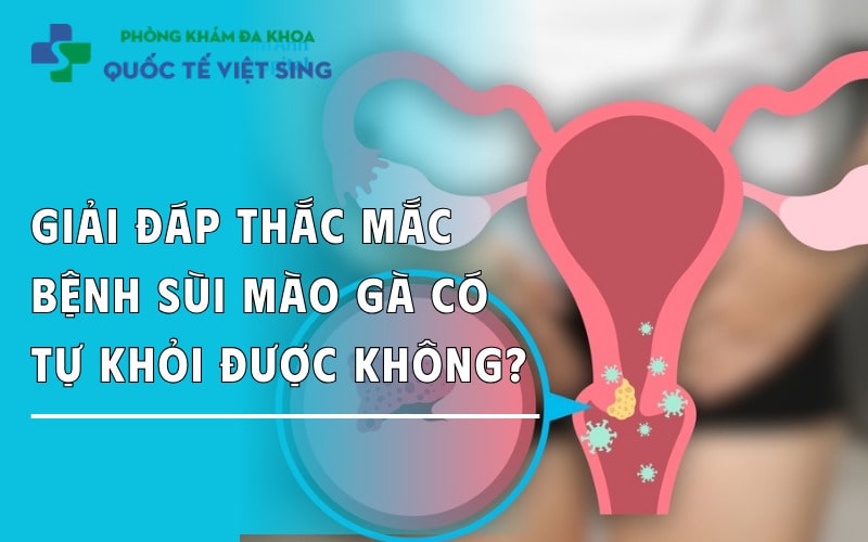 Giải đáp thắc mắc: Bị sùi mào gà có tự khỏi được không?