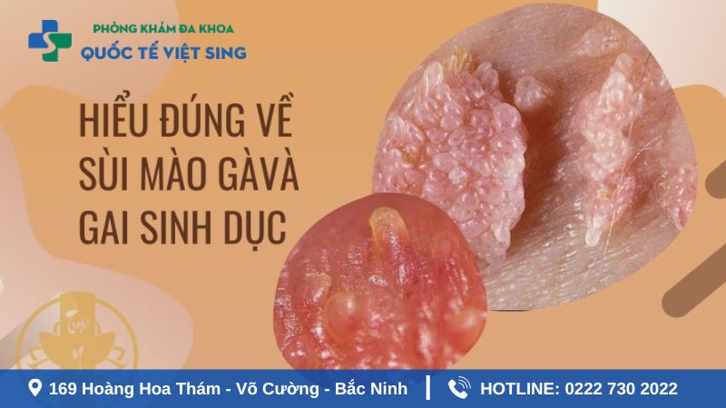Tìm hiểu về gai sinh dục và sùi mào gà ở nữ