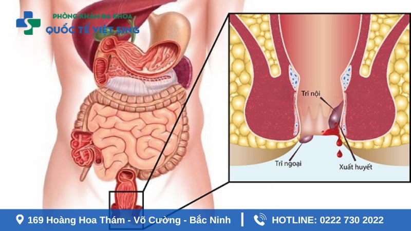 Khám hậu môn ở đâu tốt nhất? Tiêu chí lựa chọn địa chỉ khám
