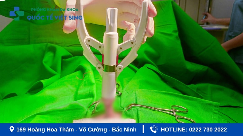 Lợi ích khi nam giới cắt bao quy đầu