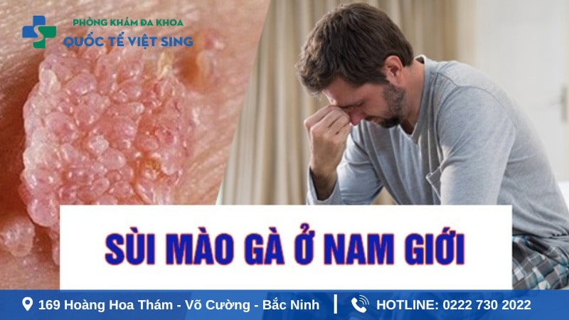 Hơn 90% trường hợp mắc sùi mào gà do quan hệ tình dục không an toàn