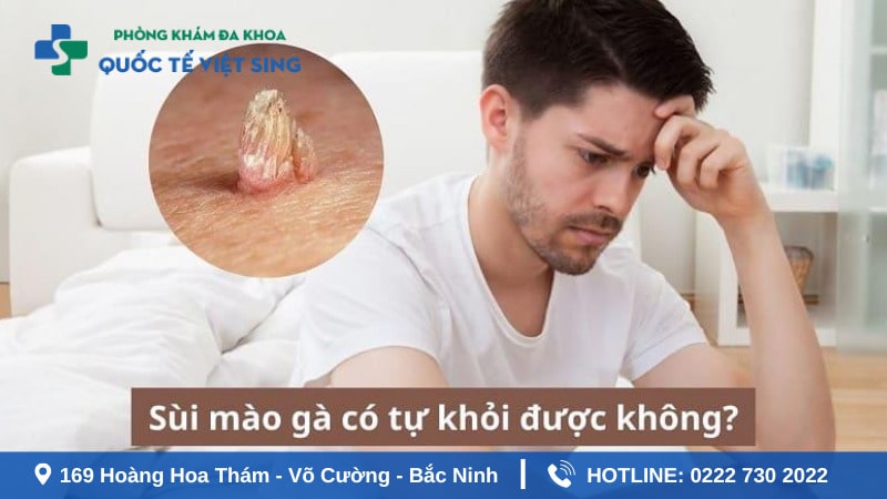 Bệnh sùi mào gà có tự khỏi được không