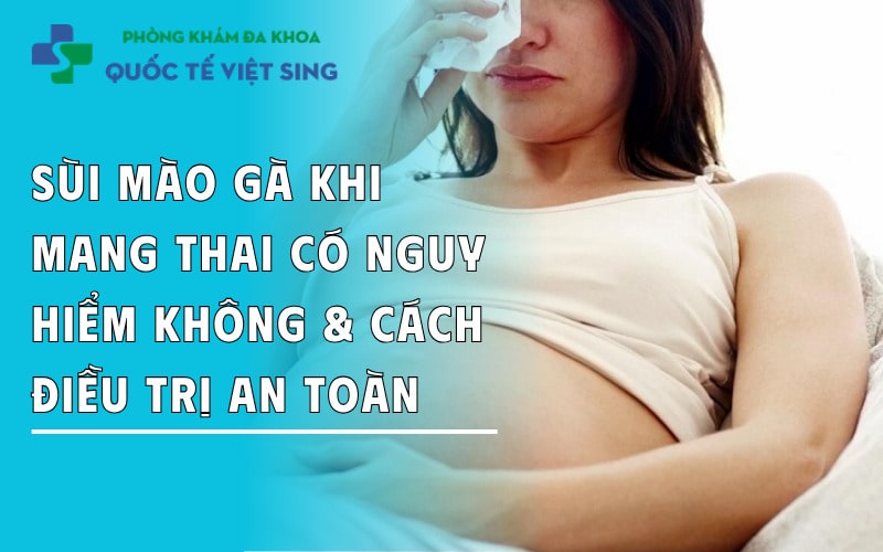 https://dakhoaquoctebacninh.com/wp-content/uploads/2025/08/sui-mao-ga-khi-mang-hai-co-nguy-hiem-khong-cach-dieu-tri-hieu-qua.jpg