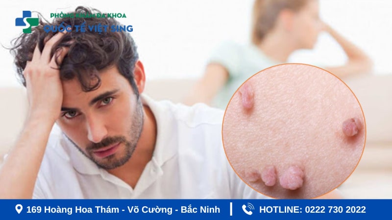 Tác hại nguy hiểm của sùi mào gà ở từng vị trí