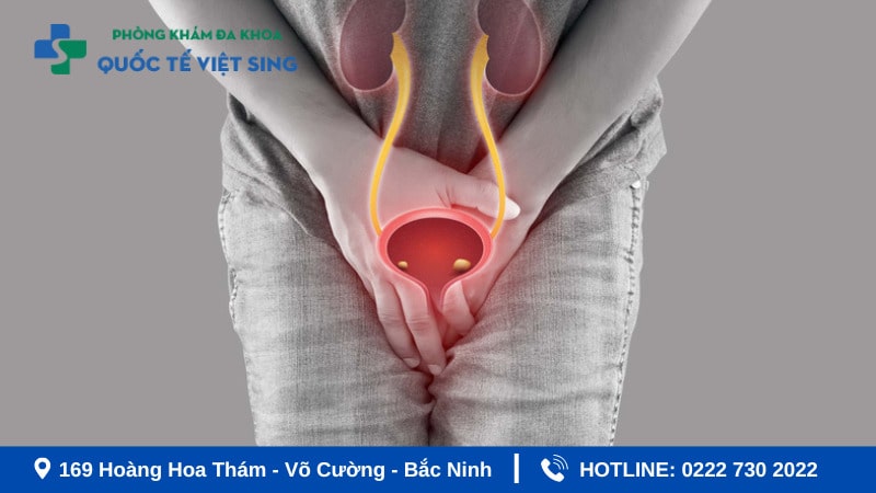 Tìm hiểu viêm niệu đạo là gì?