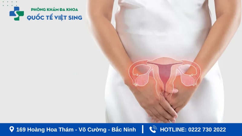 Cách điều trị viêm phụ khoa hiệu quả