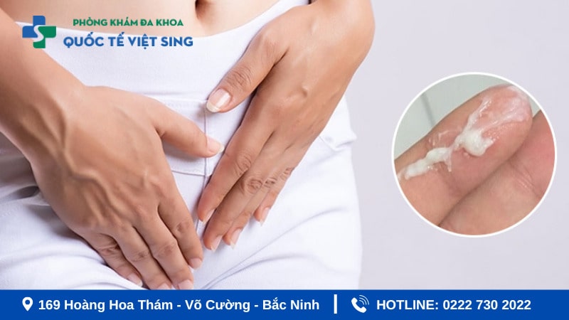 Khí hư bất thường - Dấu hiệu viêm phụ khoa 