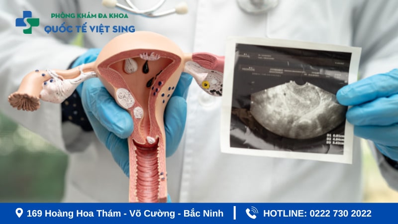 Một số lưu ý khi tiến hành Siêu âm phụ khoa