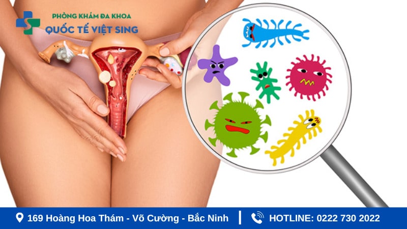 Nguyên nhân gây viêm nhiễm phụ khoa nặng