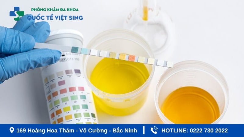 Que thử viêm nhiễm phụ khoa có thật sự chính xác?