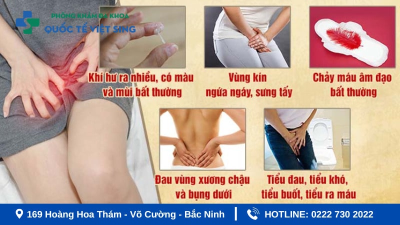 Triệu chứng viêm phụ khoa cần chú ý