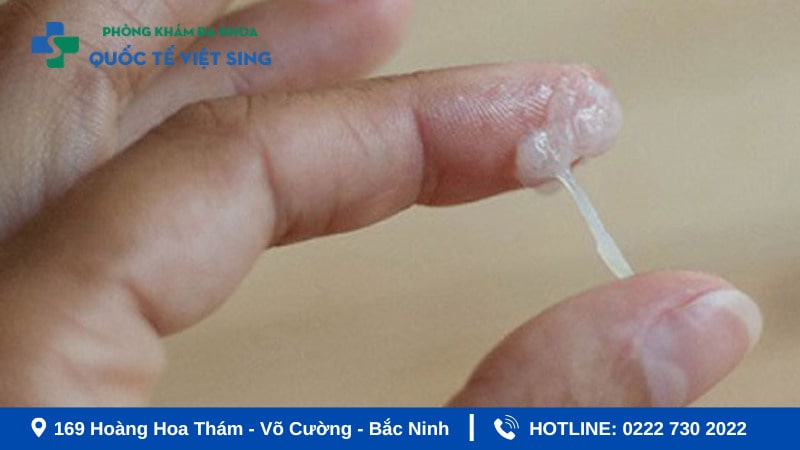 Hình ảnh viêm nhiễm phụ khoa ra khí hư bất thường