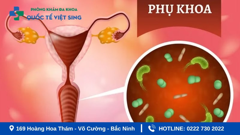 Bệnh viêm phụ khoa là gì ?
