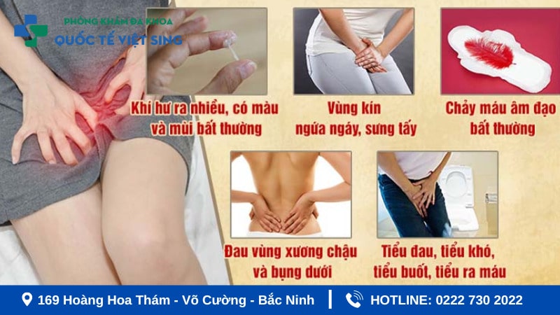 Viêm âm đạo là bệnh phụ khoa khá thường gặp ở chị em