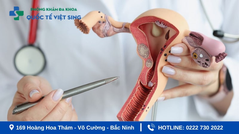 Các cách chữa viêm âm đạo hiệu quả - Chị em cần biết