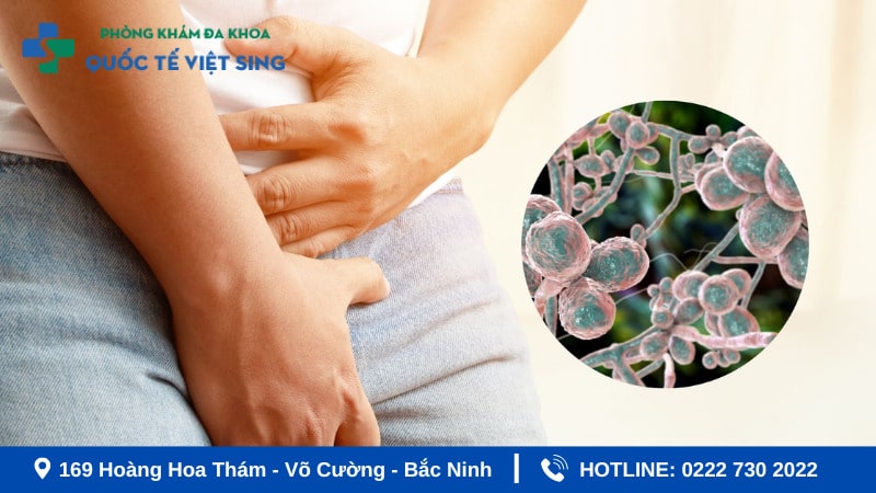 Điều trị viêm âm đạo do nấm hiệu quả