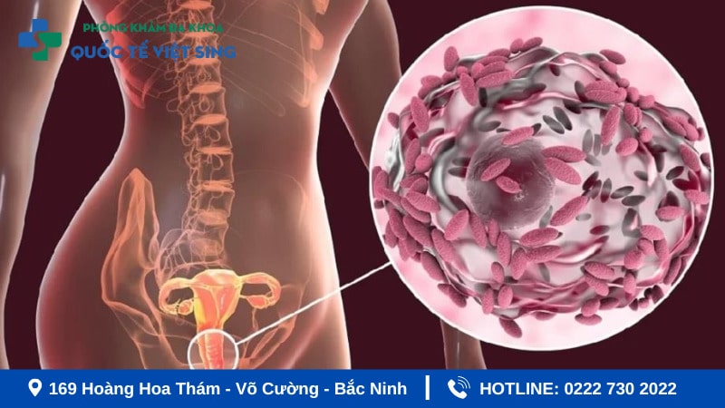 Nguyên nhân viêm âm đạo do vi khuẩn