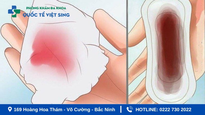 Ra máu âm đạo bất thường - Dấu hiệu viêm âm đạo cần đi khám