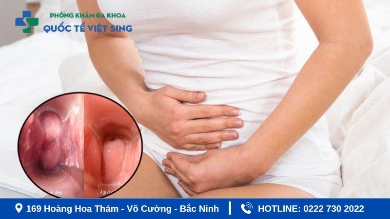 Tác nhân chính gây viêm âm đạo cho chị em