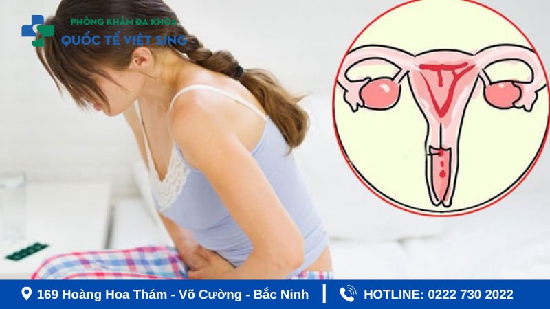 Tìm hiểu chung về viêm phụ khoa