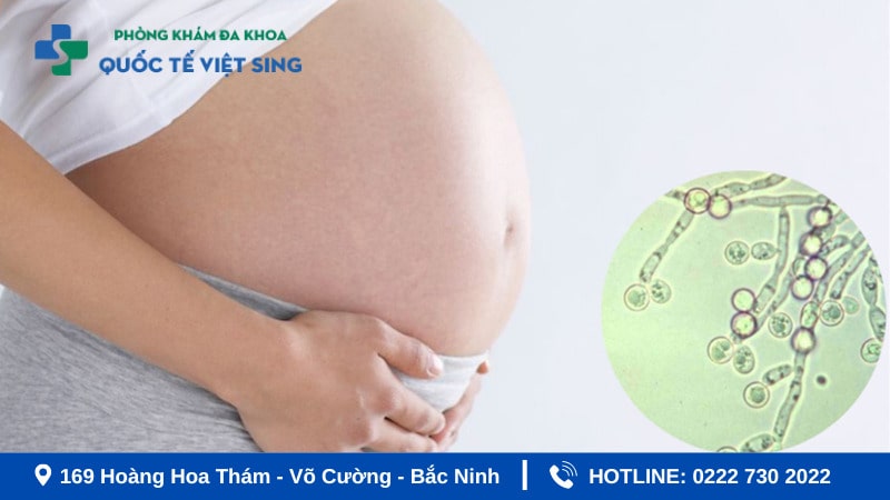 Triệu chứng của viêm âm đạo khi mang thai