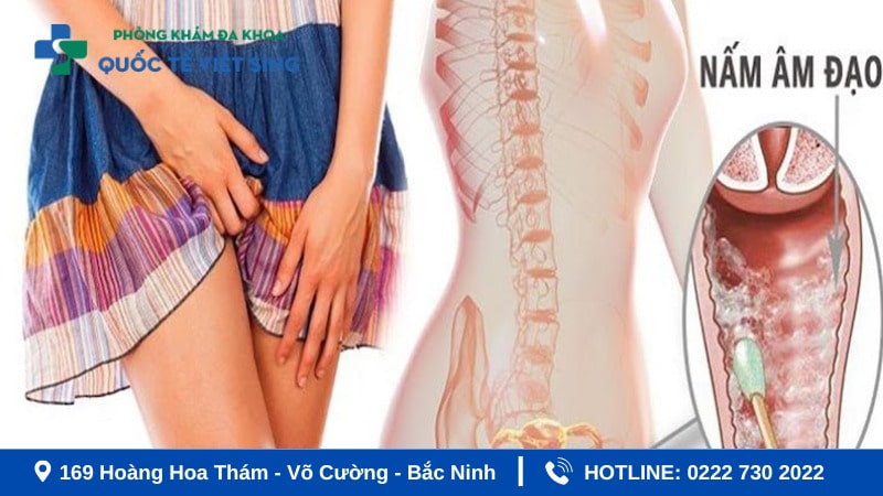Viêm âm đạo có thể tự khỏi không?