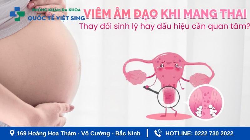 Viêm âm đạo khi mang thai là trình trạng gì?