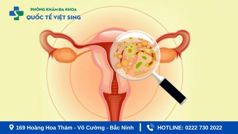 Viêm phụ khoa do vi khuẩn khi mang thai