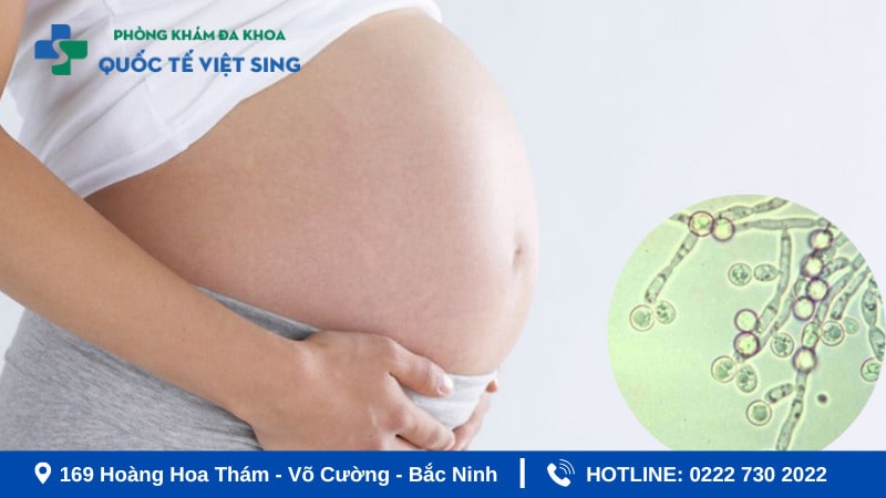 Viêm phụ khoa khi mang thai 3 tháng cuối có nguy hiểm không?