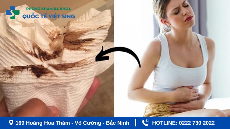 Hiện tượng ra khí hư màu nâu lẫn máu là gì?