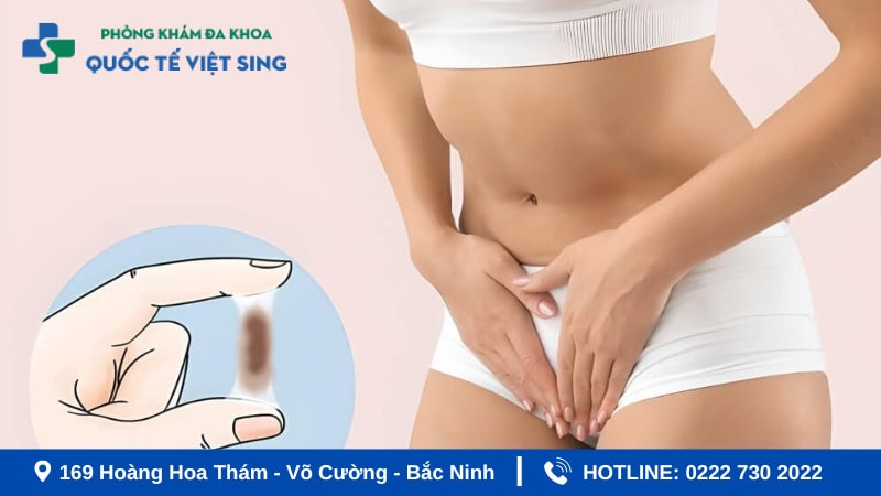 Khi nào bị ra khí hư màu nâu lẫn máu cần đi khám ngay?