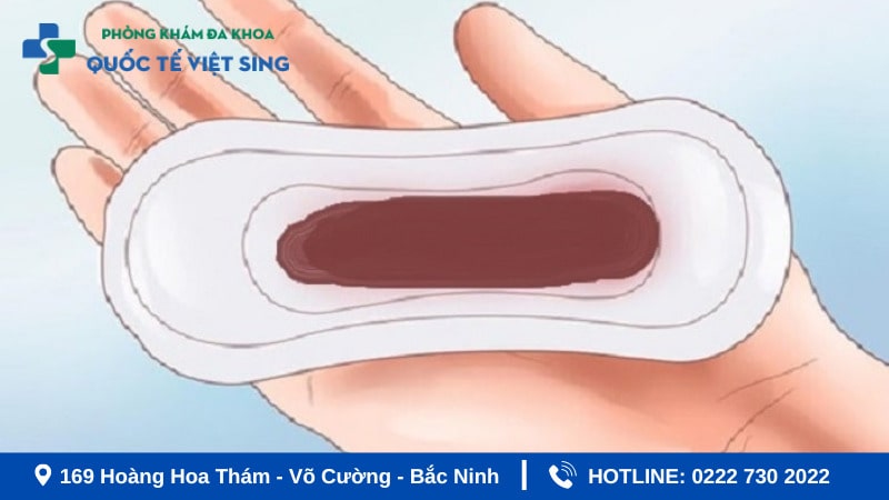 Nguyên nhân ra khí hư màu nâu lẫn máu