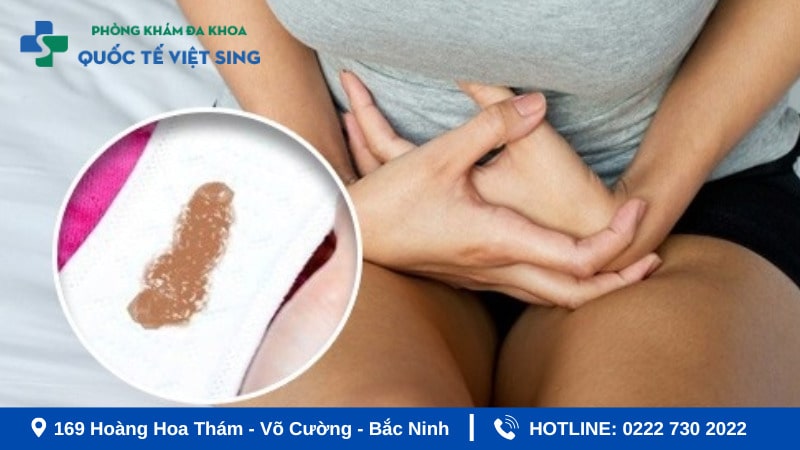 [9 Nguyên nhân] Ra khí hư có màu nâu: Khi nào cần đi khám ngay