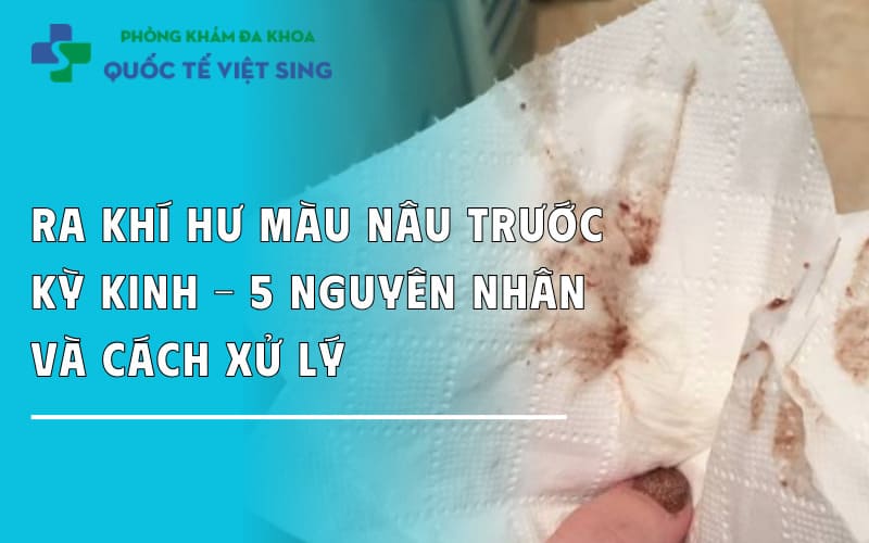 Ra khí hư màu nâu trước kỳ kinh – 5 nguyên nhân và cách xử lý